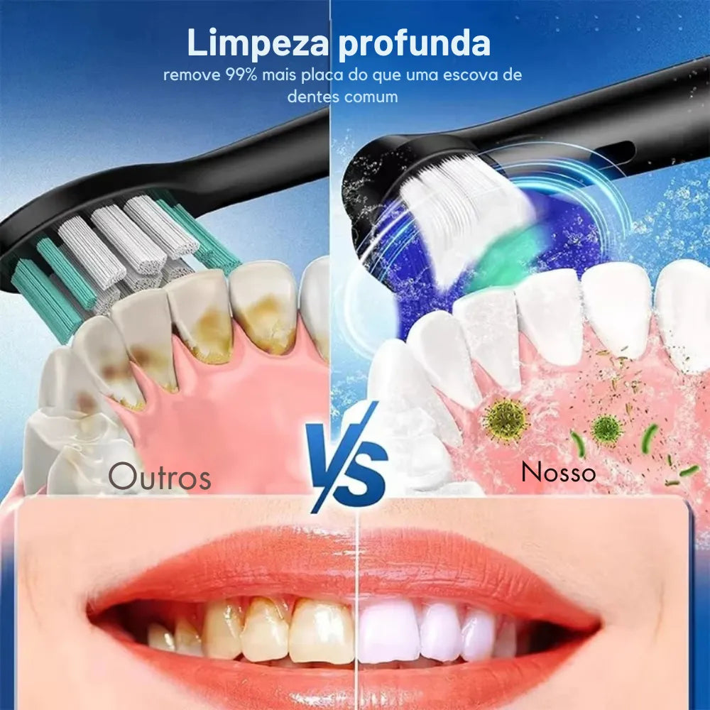 Escova-de-Dentes-Elétrica-Rotativa-Recarregável-Akivale